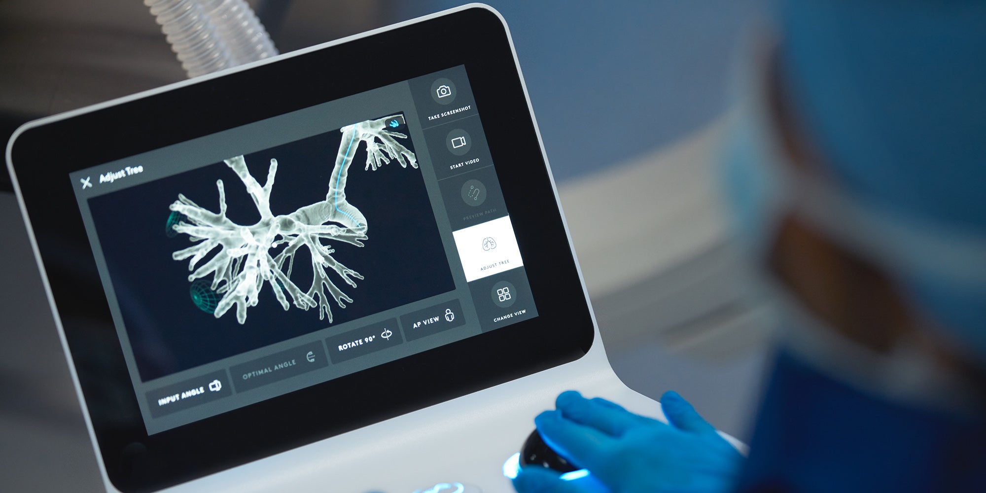 Ion Endoluminal System