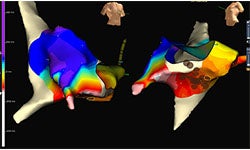 Reducing X-Ray Exposure