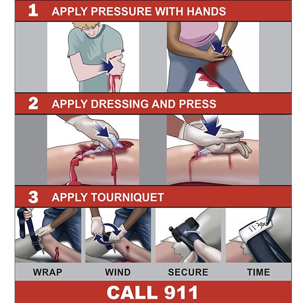 How to Stop the Bleed